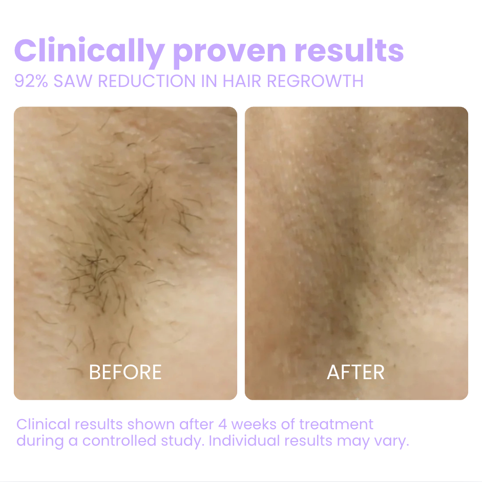 Flair Pro 2.0 SmoothSkin Hair Remover