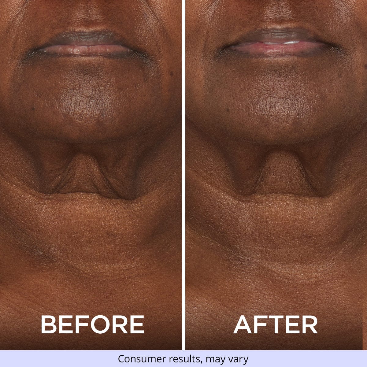 Neck Tightening Cream
