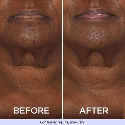 Neck Tightening Cream