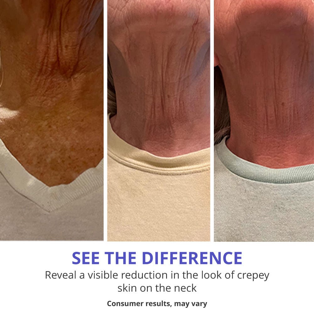 Neck Tightening Cream