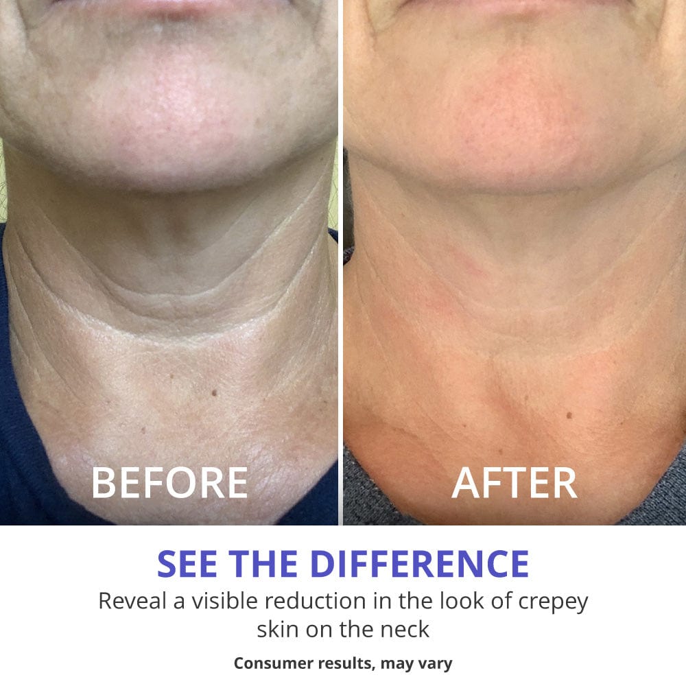 Neck Tightening Cream