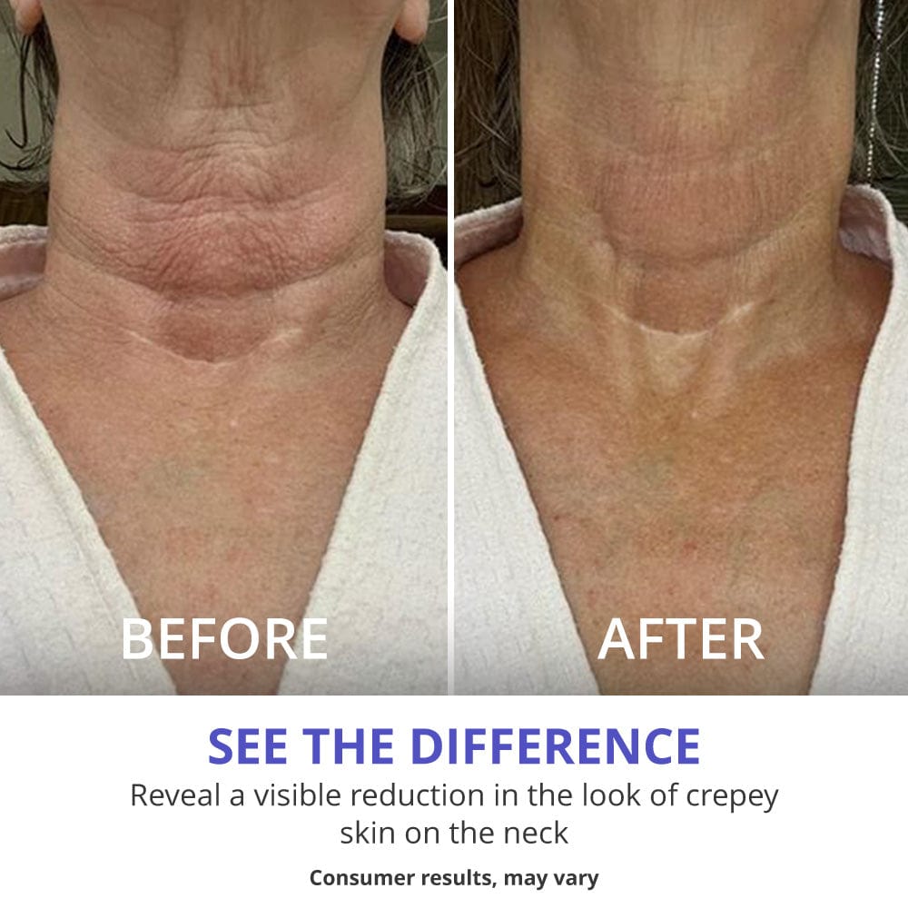 Neck Tightening Cream