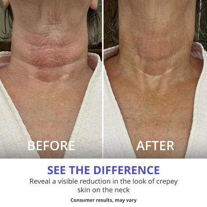 Neck Tightening Cream