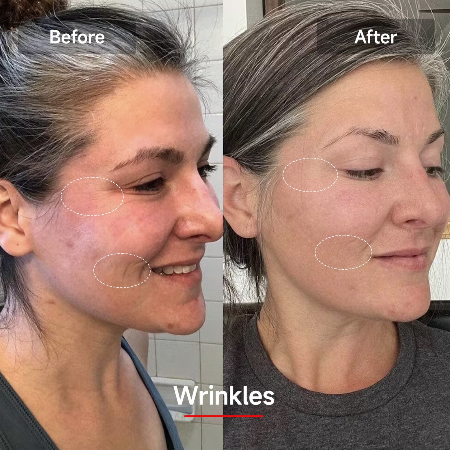 RadianceRenew™ LED Face Therapy Mask
